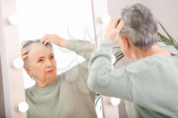Senior woman with hair loss problem near mirror�