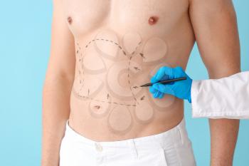 Plastic surgeon applying marking on male body against color background�