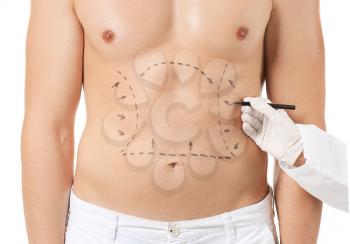 Plastic surgeon applying marking on male body against white background�
