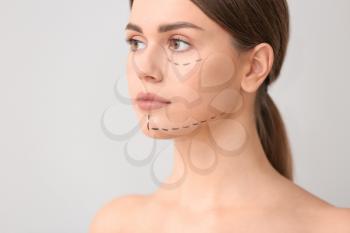 Young woman with marks on her face against light background. Concept of plastic surgery�