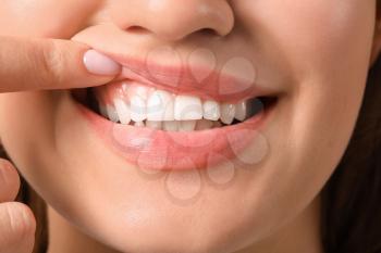 Young woman with healthy gums, closeup�