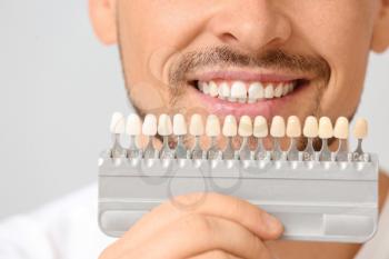 Man with teeth color samples on light background, closeup�