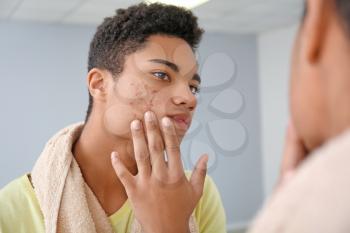African-American teenage boy with acne problem at home�