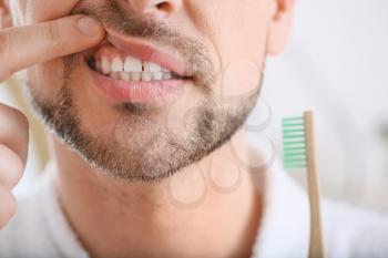 Man suffering from tooth ache in morning, closeup�