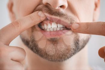 Man suffering from tooth ache, closeup�