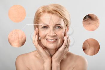 Beautiful mature woman with skin problem on light background. Process of aging�