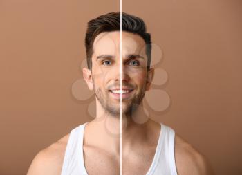 Comparison portrait of man on color background. Process of aging�