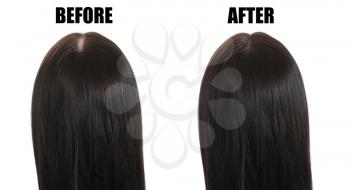 Woman before and after hair loss treatment on color background�