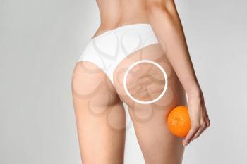Young woman with orange on light background. Problem of cellulite�