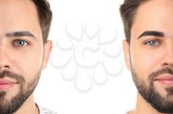 Young man before and after eyebrows correction on white background�