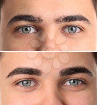 Young man before and after eyebrows correction, closeup�