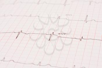 Royalty Free Photo of an Electrocardiogram