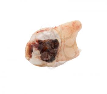 tooth on a white background
