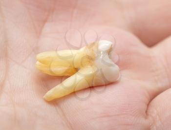 tooth hand. macro