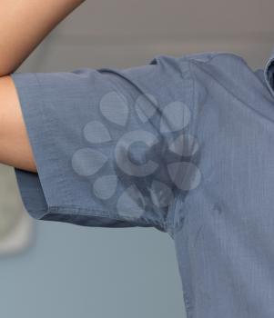 Man with hyperhidrosis sweating very badly under armpit in blue shirt