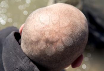 A round bald head in a man in nature