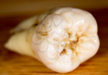 A tooth torn by a doctor in dentistry