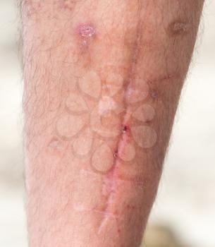 scars on his leg