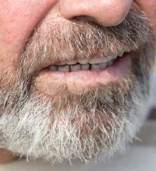 overgrown beard man