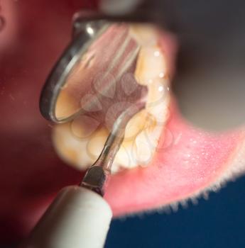 dental treatment in dentistry