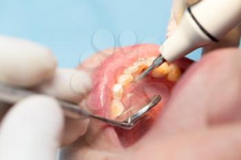 dental treatment in dentistry