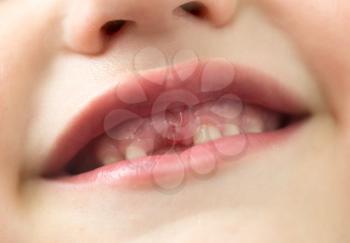 The mouth of a boy without a tooth .