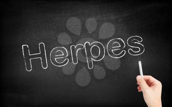 Herpes written on white blackboard