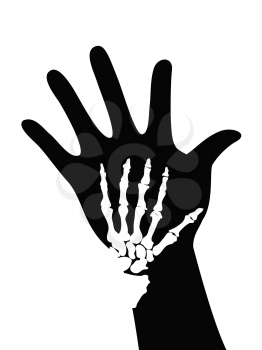Royalty Free Clipart Image of Bones on a Hand