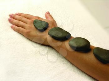 Royalty Free Photo of an Arm With Hot Stones