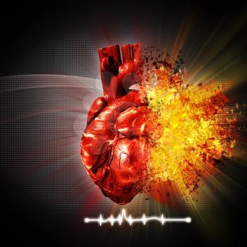 heart attack. abstract medical and health care backgrounds