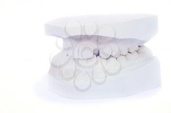 Royalty Free Photo of a Gypsum Model of Teeth