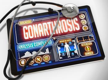 Gonarthrosis - Diagnosis on the Display of Medical Tablet and a Black Stethoscope on White Background.