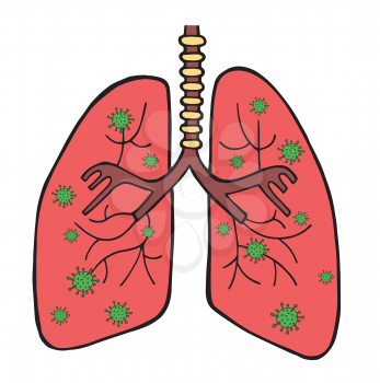 Hand drawn vector illustration of Wuhan corona virus, covid-19. Viruses in the lungs. 