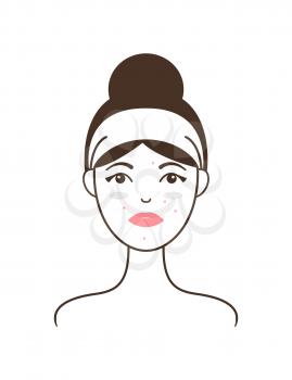 Young girl in headband with acne and dark circles under eyes isolated cartoon vector illustration on white background. Skin problems on female model.