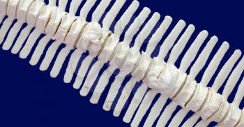 Spine of a dolphin, isolated over blue background