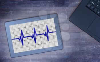 Electrocardiogram on a tablet - Concept of healthcare, heartbeat shown on monitor - blue