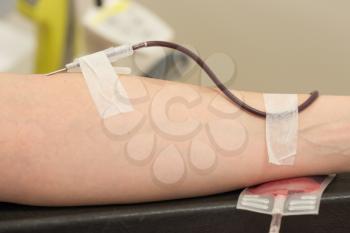 Donor in an armchair donates blood at hemotransfusion station, close-up