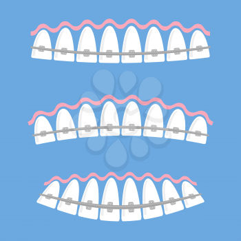 Medical Braces Teeth. Dental Care Background. Orthodontic Treatment. Cartoon Opening Mouth.