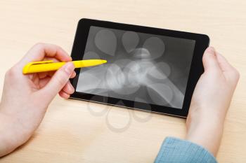 student analyzes X-ray picture of human knee-joint on screen on tablet pc