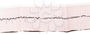 electrocardiogram (ECG, EKG) on paper isolated on white background
