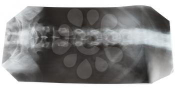 X-ray photo of human spinal column isolated on white background