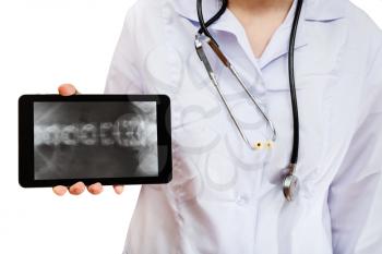 nurse holds tablet pc with X-ray picture of human spinal column on screen isolated on white background