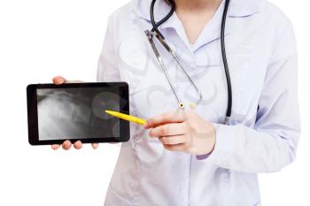 nurse points tablet pc with X-ray picture of human vertebral column on screen isolated on white background
