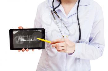 nurse points on tablet pc with dental X-ray picture of human jaws on screen isolated on white background