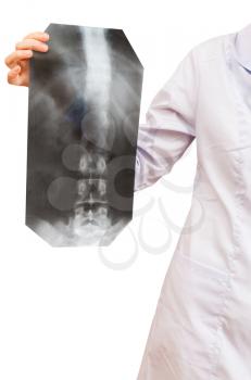 nurse shows X-ray picture with human vertebral column isolated on white background