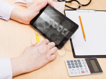 medic look on X-ray picture of human vertebral column on tablet pc