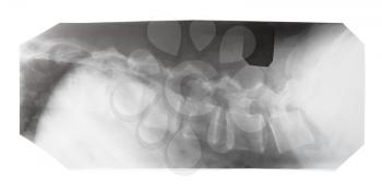 film with X-ray image of side view of human spine isolated on white background