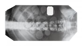film with X-ray image of front view of human spine isolated on white background