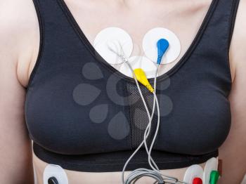 sensors of Holter monitor for electrocardiogram are attached to woman's torso