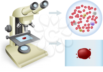Analysis of blood under a microscope on a white background, two views